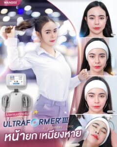 รีวิว Ultraformer-lll