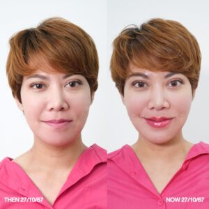 รีวิวฟิลเลอร์