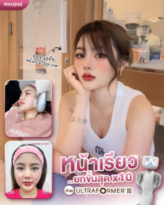 รีวิว Ultraformer-lll