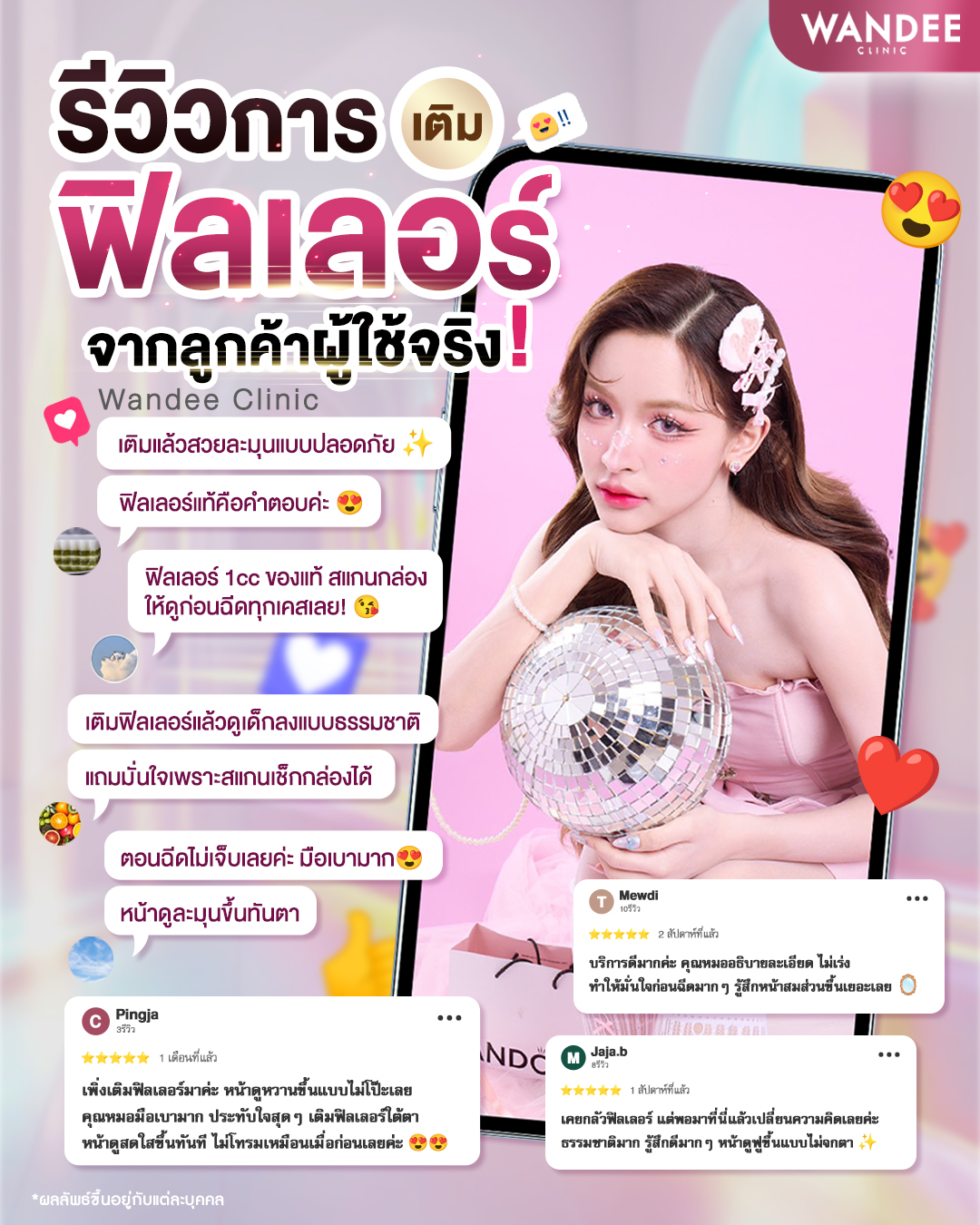 รีวิวฟิลเลอร์