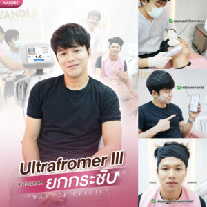 รีวิว Ultraformer-lll