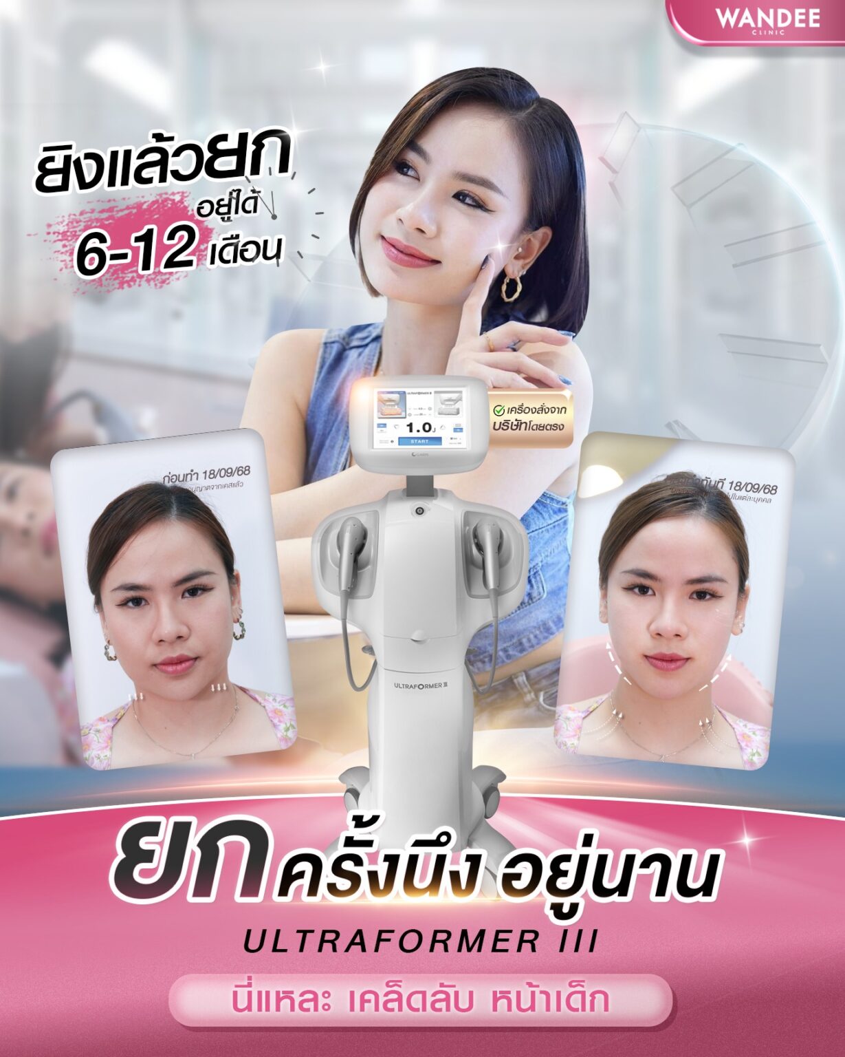 รีวิว Ultraformer-lll