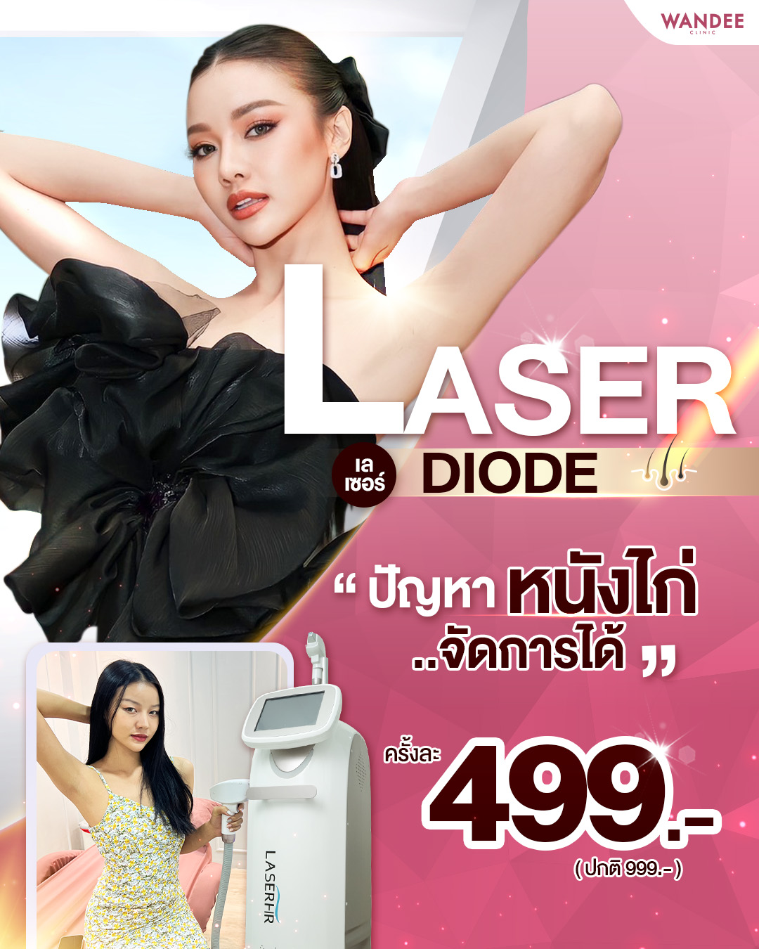 6-3-67 Laser ขนรักแร้