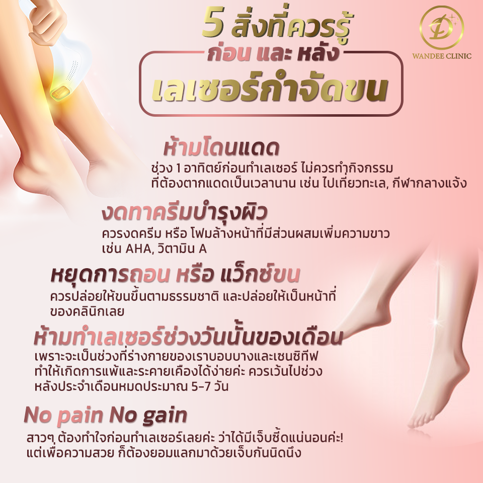 เลเซอร์