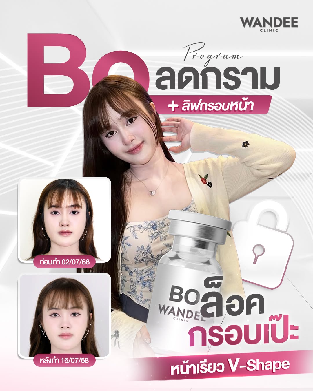 รีวิว โบท็อกซ์ นิวเยียร์