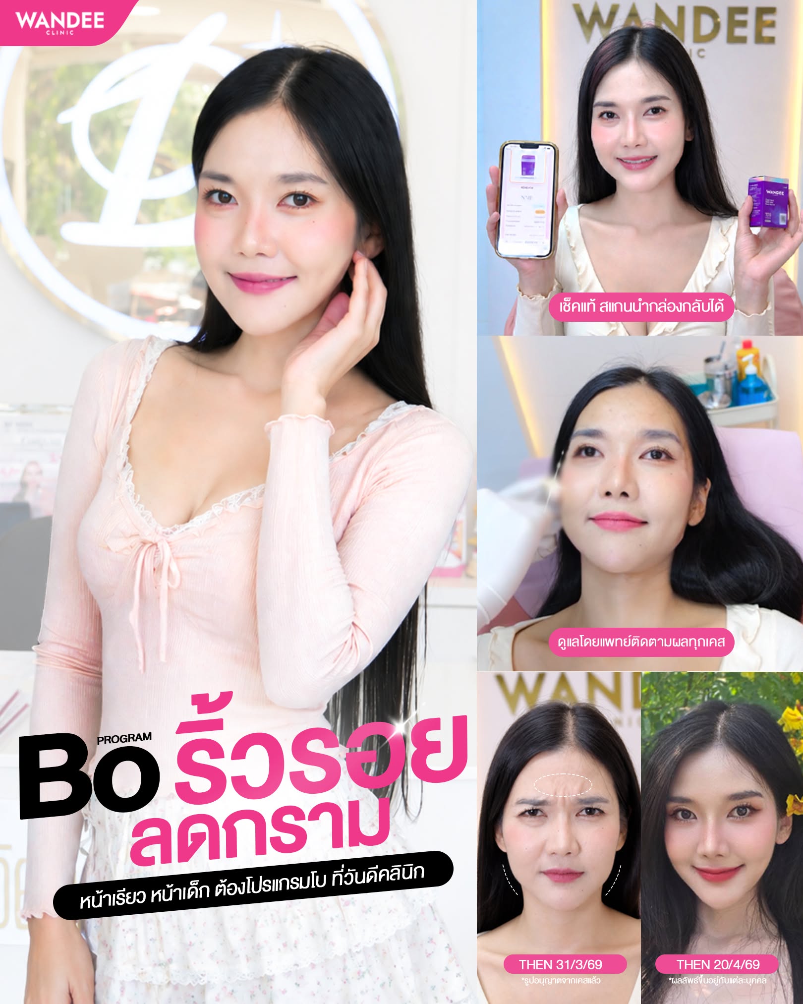 รีวิวโบม่วง