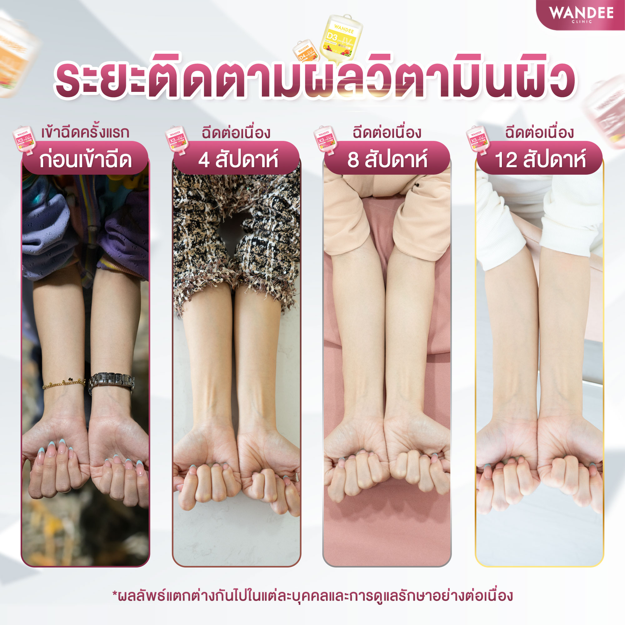 เข้ารับบริการฉีดวิตามินผิว04 (1)